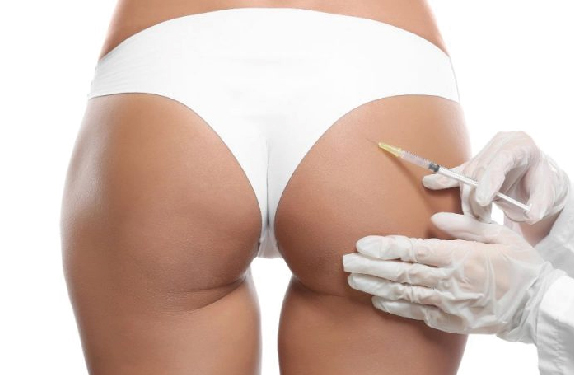 Lanluma X en Glúteos